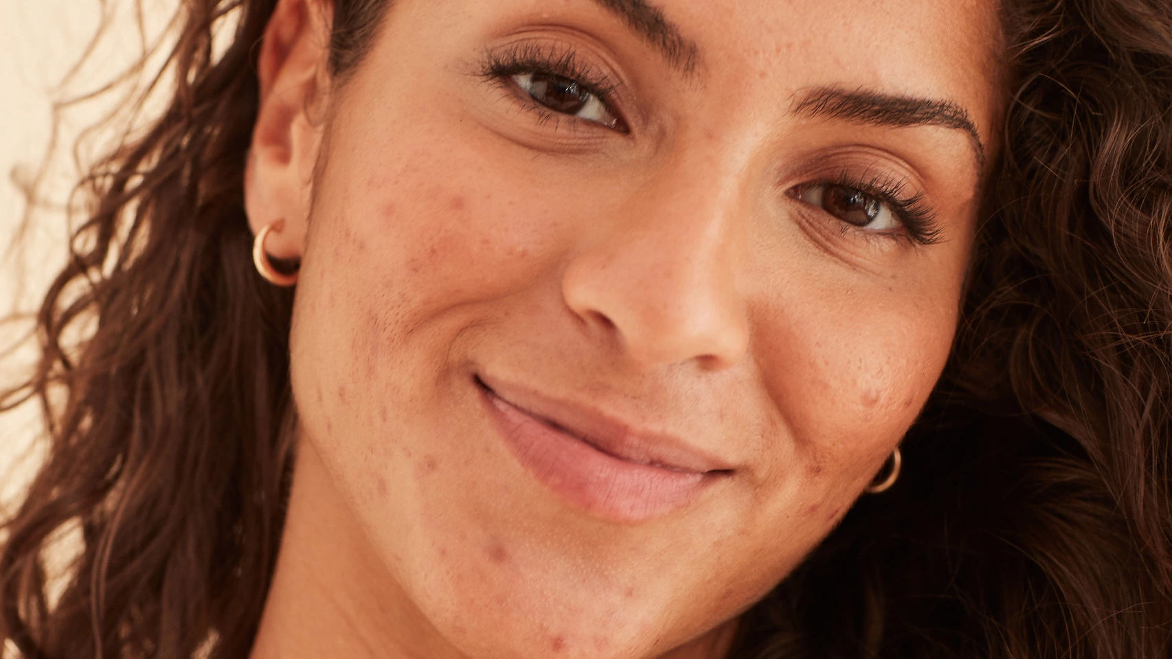 BCNscience_Pacientes_Derma_Foto-16