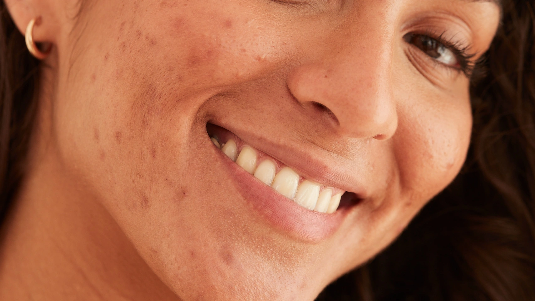 CNscience_Pacientes_Derma_Foto-16